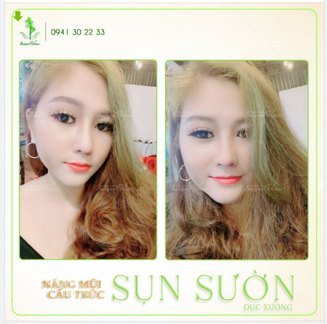 TRĂM NGÀN QUẢNG CÁO KHÔNG BẰNG FEEDBACK CHÂN THẬT