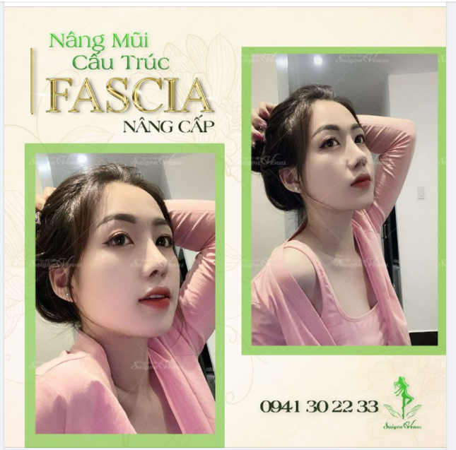 TRẦN HUYỀN MY THÁCH THỨC MỌI "GÓC CHẾT"