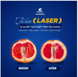 TRẺ HÓA (LASER) BÍ QUYẾT “GIỮ CHẶT” TRÁI TIM CHÀNG