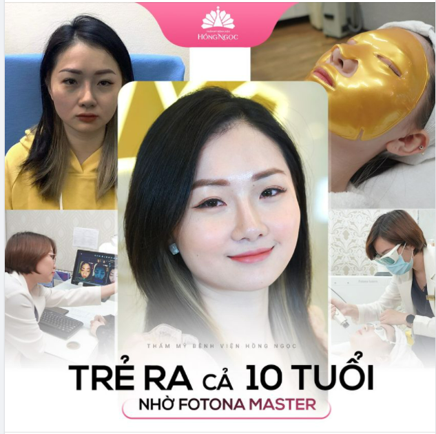 TRẺ RA 10 TUỔI NHỜ CÔNG NGHỆ DẪN ĐẦU 2021 FOTONA MASTER