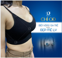 TREO SA TRỄ CHỈ 0Đ - Đăng ký nhận ưu đãi 10TRD.