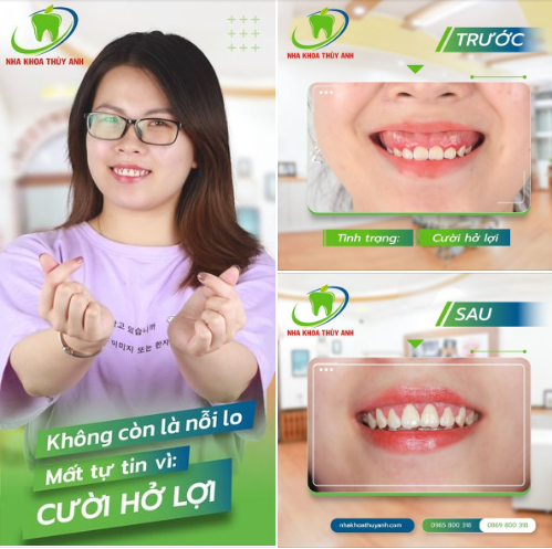 TRỊ CƯỜI HỞ LỢI, TĂNG NGÀN SỰ TỰ TIN