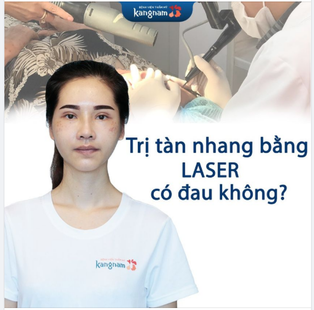Trị tàn nhang bằng laser có đau không? Câu trả lời là KHÔNG.