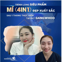 TRÌNH LÀNG SIÊU PHẨM MÍ (4IN1) ĐẸP XUẤT SẮC SAU 1 THÁNG THỰC HIỆN TẠI BVTM GANGWHOO