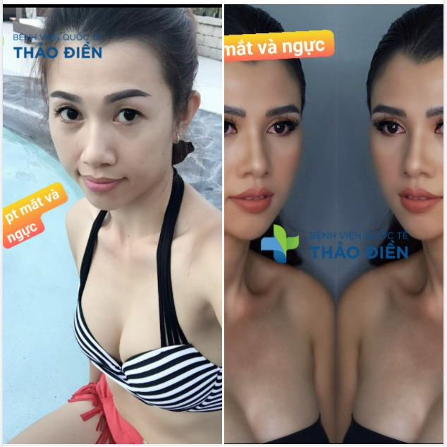​​​​​​​ Trở thành" Cô Gái Lột Xác Ngoạn Mục"..