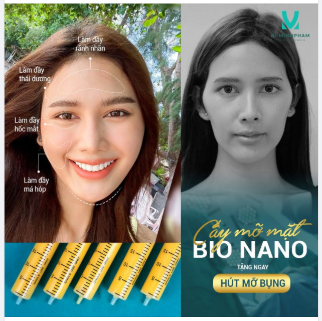 TRỜI ƠI TIN ĐƯỢC KHÔNG!!??? CẤY MỠ MẶT – TẶNG MIỄN PHÍ HÚT MỠ BỤNG