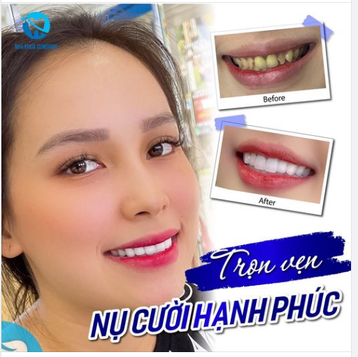 TRỌN VẸN NỤ CƯỜI HẠNH PHÚC CÙNG SUNSHINE
