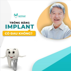TRỒNG RĂNG IMPLANT CÓ ĐAU KHÔNG