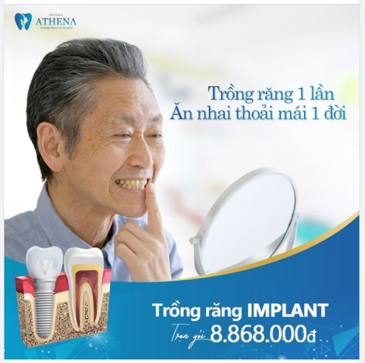 ​ Trồng Răng Implant Tại Nha Khoa Athena - Xua Tan Nỗi Lo Mất Răng