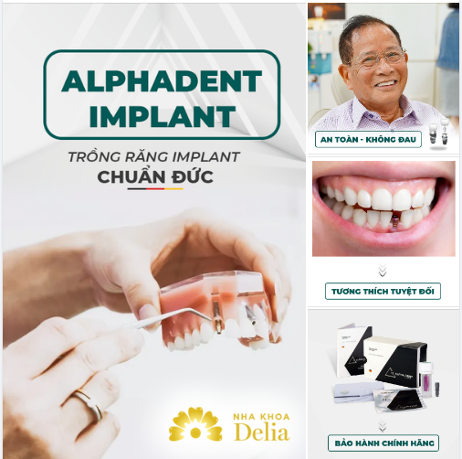 TRỤ IMPLANT CHUẨN ĐỨC TÍCH HỢP VƯỢT TRỘI