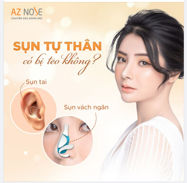 Trước khi nâng mũi, chị khách cũng đã tìm hiểu rất nhiều thông tin và cũng có tư vấn một số nơi.