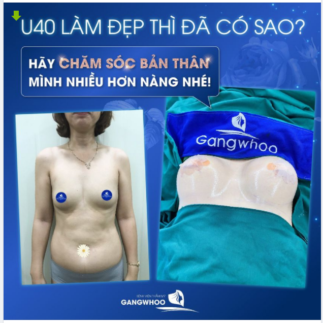U40 LÀM ĐẸP THÌ ĐÃ SAO