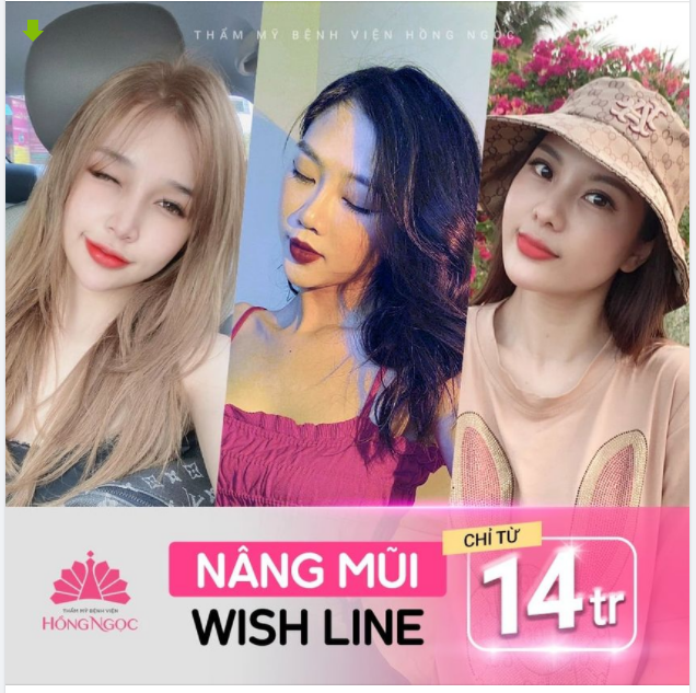 ƯU ĐÃI CÓ 1:0:2 NÂNG MŨI WISH LINE CHỈ TỪ 14TR