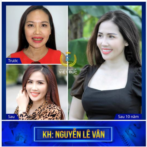 UY TÍN CHẤT LƯỢNG THỂ HIỆN Ở NỤ CƯỜI CỦA KHÁCH HÀNG SAU 10 NĂM THẨM MỸ RĂNG SỨ