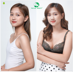 V1 ĐẸP NHƯ MƠ - CHI PHÍ RẺ BẤT NGỜ