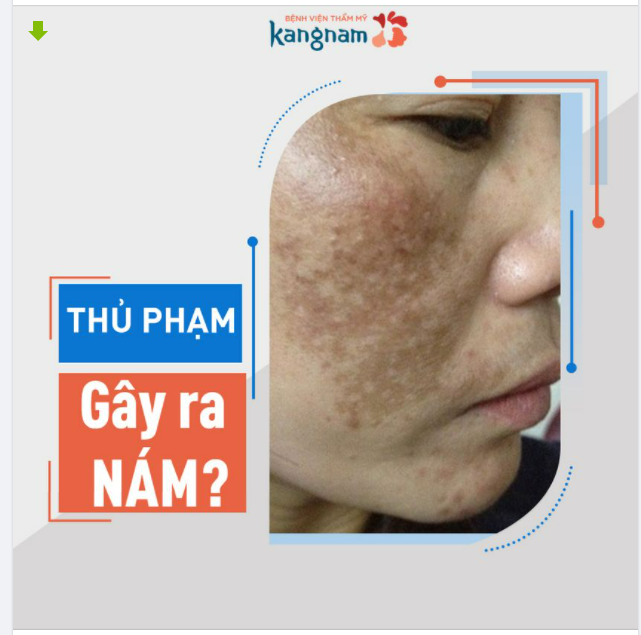Vạch trần 7 THỦ PHẠM gây ra NÁM