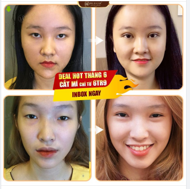 VẠN DEAL SIÊU HOT Ưu đãi cực đã HOT nhất tháng 6 này Bạn đã biết tin gì chưa?