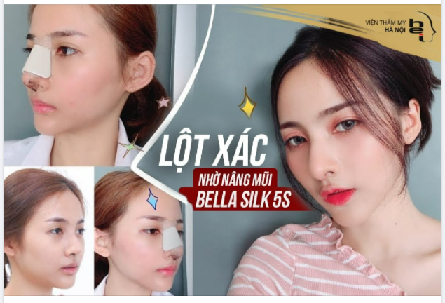 Vẫn là em, chỉ là trước và sau khi 'LỘT XÁC" thôi