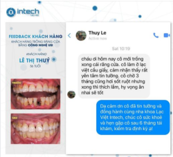 VẠN LỜI NÓI KHÔNG BẰNG MỘT LẦN TRẢI NGHIỆM CỦA KHÁCH HÀNG TRỒNG RĂNG IMPLANT TẠI NHA KHOA LẠC VIỆT INTECH