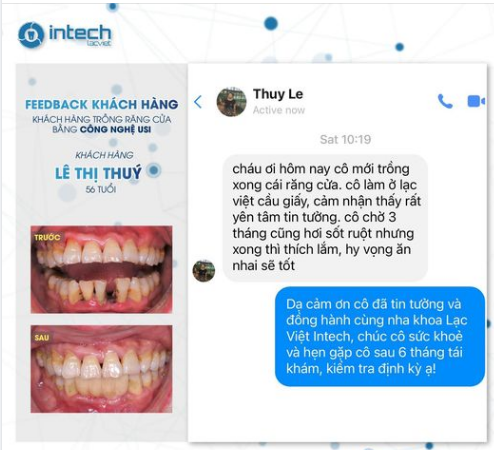 VẠN LỜI NÓI KHÔNG BẰNG MỘT LẦN TRẢI NGHIỆM CỦA KHÁCH HÀNG TRỒNG RĂNG IMPLANT TẠI NHA KHOA LẠC VIỆT INTECH