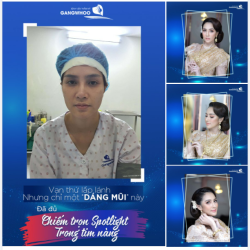 VẠN THỨ LẤP LÁNH NHƯNG CHỈ CÓ "DÁNG MŨI" NÀY MỚI CHIẾM SPOTLIGHT TRONG TIM NÀNG