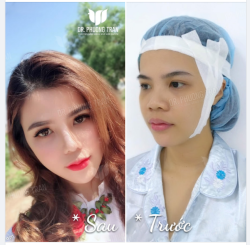 VÌ ĐẸP LÀ CÓ QUYỀN! Nghe vô lý nhưng hoàn toàn thuyết phục.