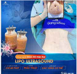 VÌ SAO BẠN NÊN SỬ DỤNG LIPO ULTRASOUND