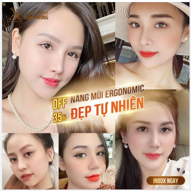 VÌ SAO TRỞ THÀNH HOTGIRL SAU NÂNG MŨI