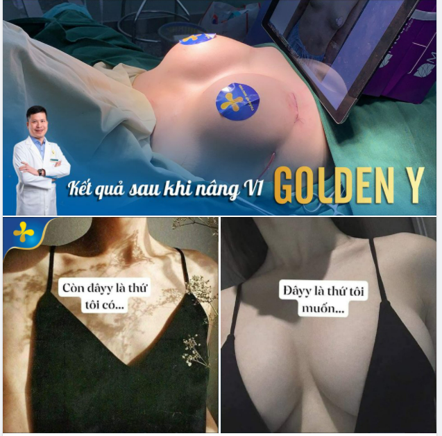 Vòng 1 có cũng như không, đến một chút “nhấp nhô” cũng chẳng thấy.