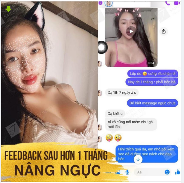 VÒNG 1 NÂNG CẤP SAU 1 THÁNG 7 NGÀY