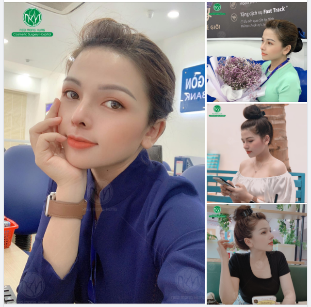 VỪA ĐẸP VỪA SANG CHỈ SAU NÂNG MŨI