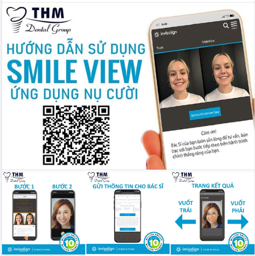 XEM TRƯỚC KẾT QUẢ NIỀNG RĂNG NGAY TẠI NHÀ VỚI CÔNG NGHỆ SMILE VIEW