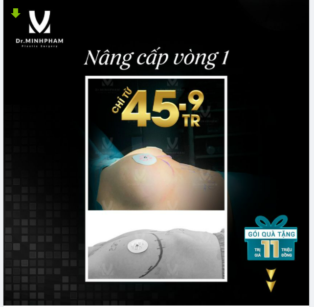 XINH MUỐN XỈU NGỰC ĐẸP CHỈ TỪ 45,9TR – BẢO HÀNH TRỌN ĐỜI