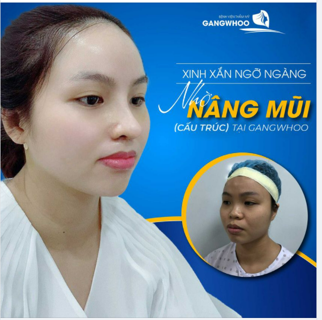 XINH XẮN NGỠ NGÀNG NHỜ NÂNG MŨI (CẤU TRÚC) TẠI GANGWHOO