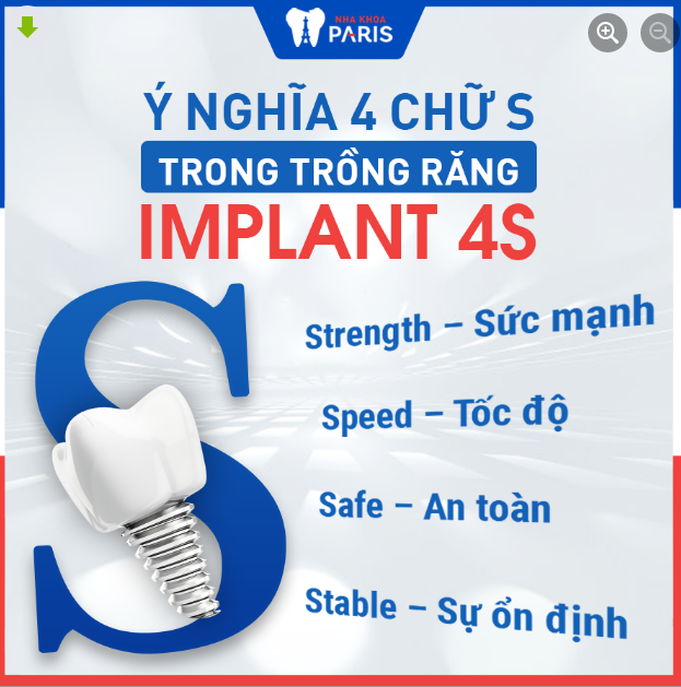 Ý NGHĨA 4 CHỮ S TRONG TRỒNG RĂNG IMPLANT 4S