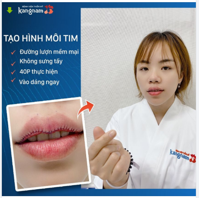 Ý nghĩa MÔI TRÁI TIM theo nhân tướng học