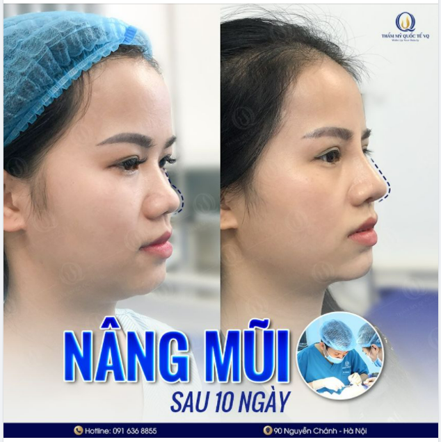 1 góc nghiêng 2 thần thái