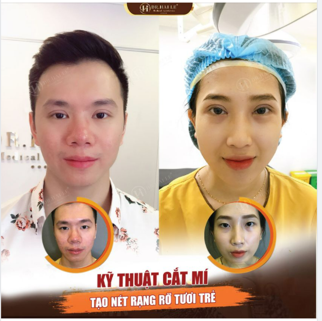 3 TIÊU CHÍ ĐỂ LỰA CHỌN CƠ SỞ CẮT MÍ UY TÍN!
