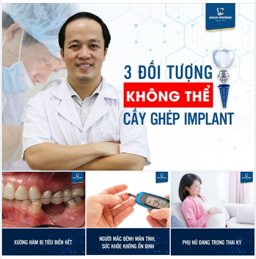 3 TRƯỜNG HỢP TIỀN MUÔN BẠC VẠN CŨNG CHẲNG THỂ CẮM IMPLANT