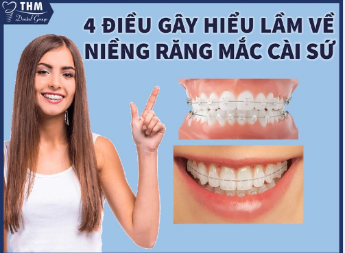 4 ĐIỀU GÂY HIỂU LẦM VỀ NIỀNG RĂNG MẮC CAI SỨ