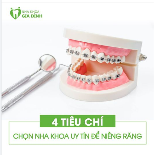 4 tiêu chí đánh giá nha khoa uy tín để niềng răng