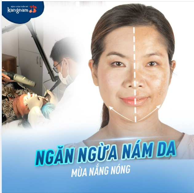 5 cách ngăn ngừa nám da trong mùa nắng nóng️