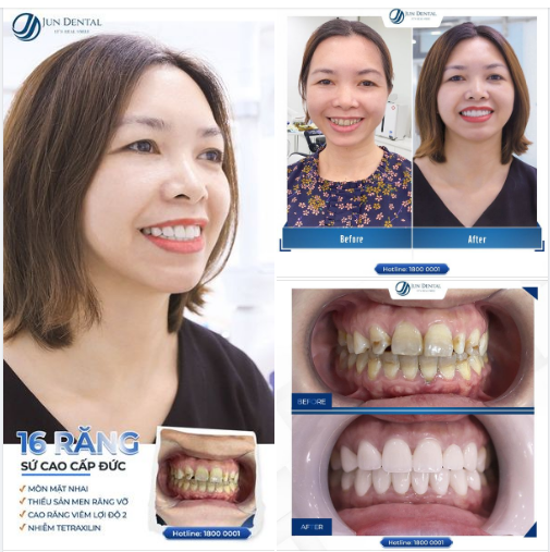 AI BẢO THANH XUÂN KHÔNG THỂ TRỞ LẠI?