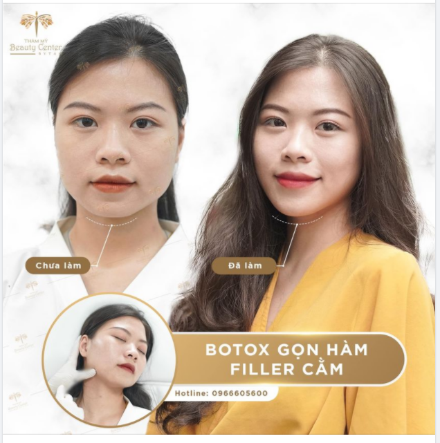 “Ai cũng hỏi em sao dạo này xinh thế. Công nhận nhìn khác hẳn ngày xưa. “