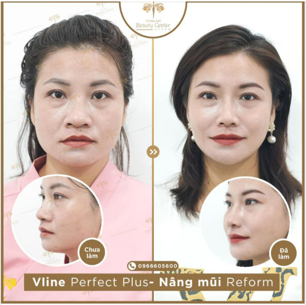 “ Ai cũng khen nhìn sang hơn, trẻ hơn em ạ. Cám ơn đội ngũ của Tấm nhé.”