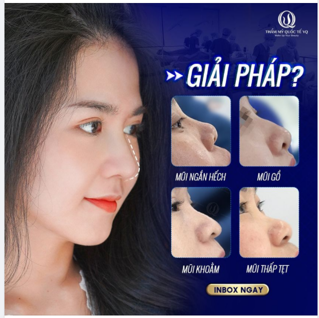 Ai cũng mong muốn mình có một dáng mũi đẹp, chuẩn phong thủy nhưng đa số người Việt Nam sinh ra đều có ít nhiều những khuyết điểm như mũi hếch mũi gồ mũi khoằm mũi tẹt