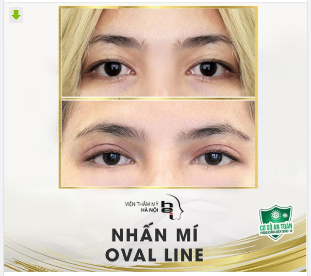 ẢNH THẬT - KẾT QUẢ THẬT