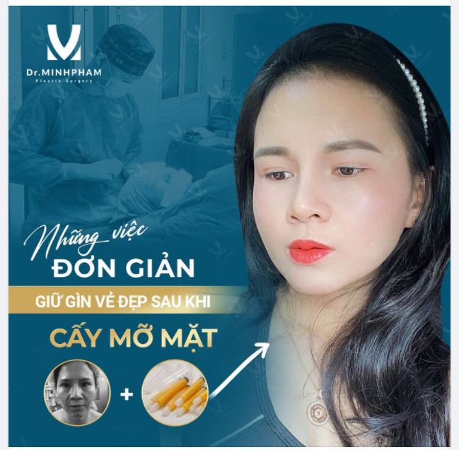 BẠN CÓ BIẾT!!?? NHỮNG VIỆC ĐƠN GIẢN GÌN GIỮ VẺ ĐẸP SAU CẤY MỠ MẶT?