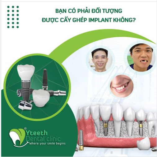 BẠN CÓ PHẢI ĐỐI TƯỢNG ĐƯỢC CẤY GHÉP IMPLANT KHÔNG?