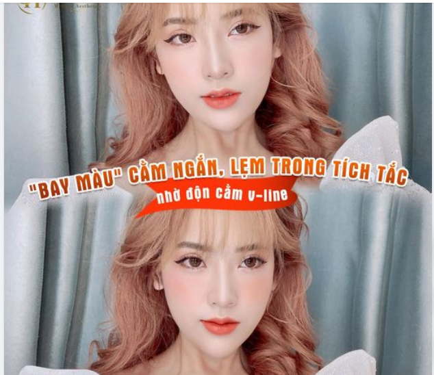 Bay màu cằm ngắn, lẹm trong tích tắc nhờ Độn cằm V line